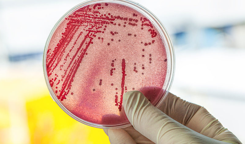 E-coli Bakterien im Darm